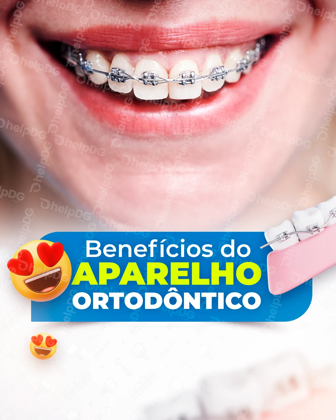 01---Benefícios-do-aparelho-ortodôntico